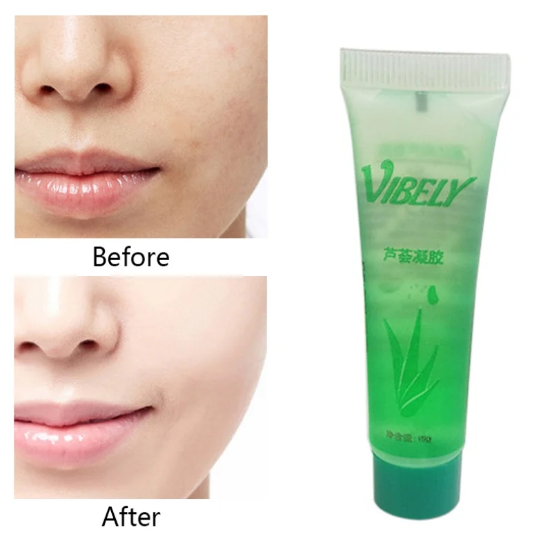 1 шт. унисекс Aloe Vera Gel маски отбеливает отпечаток Блейн шрам вогнутый отверстие