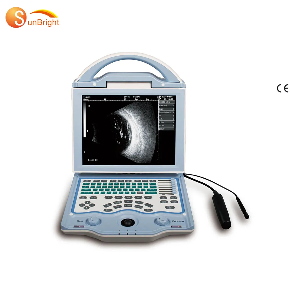 

a/b scan ophthalmic ultrasound SUN-AB, ophthalmology, portable ophthalmic