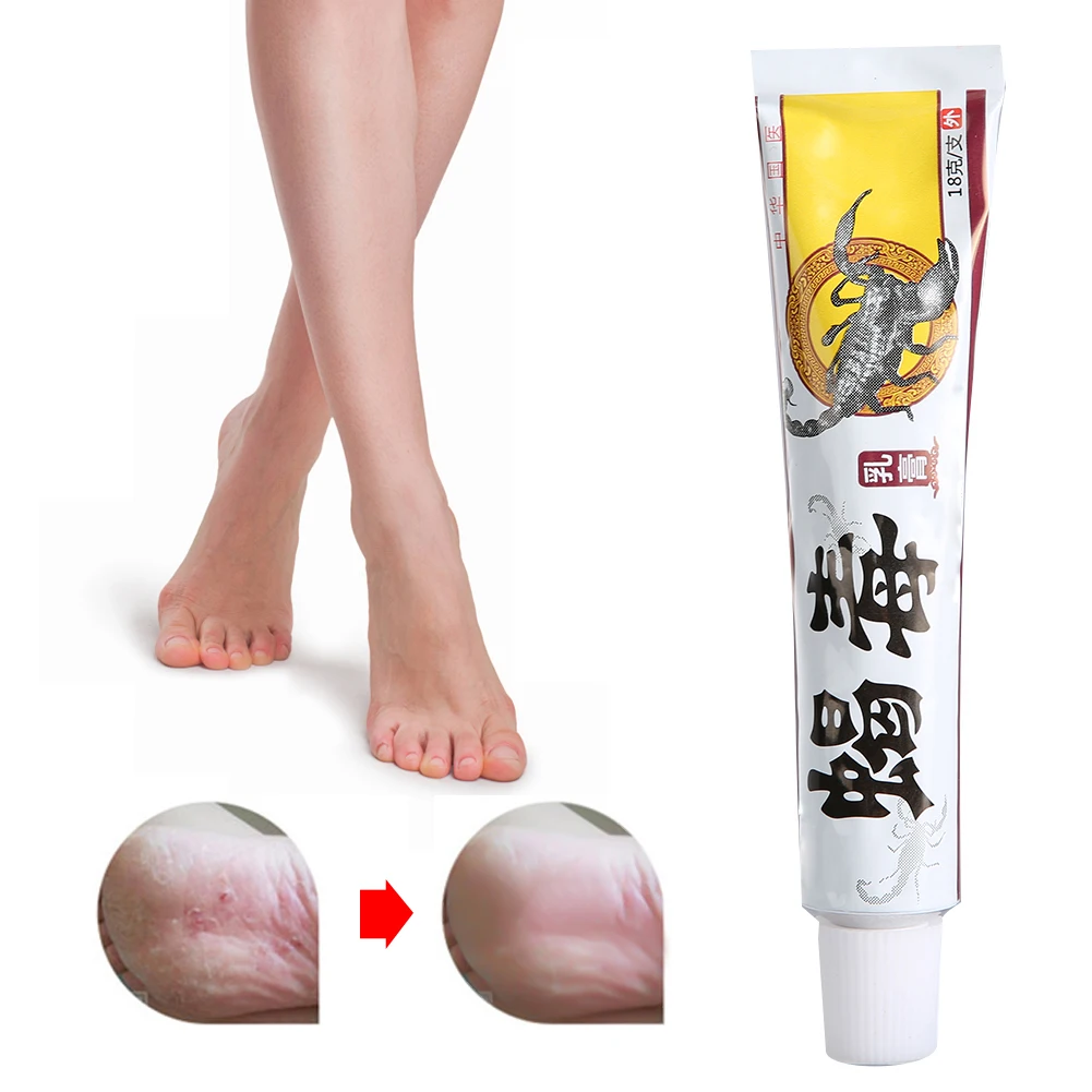 

18g Chinese Herbal Antibacteria Cream Dermatitis Eczema Mosquito Bites Antibacteria Ointment Skin Care Herbal Extract Not Greasy