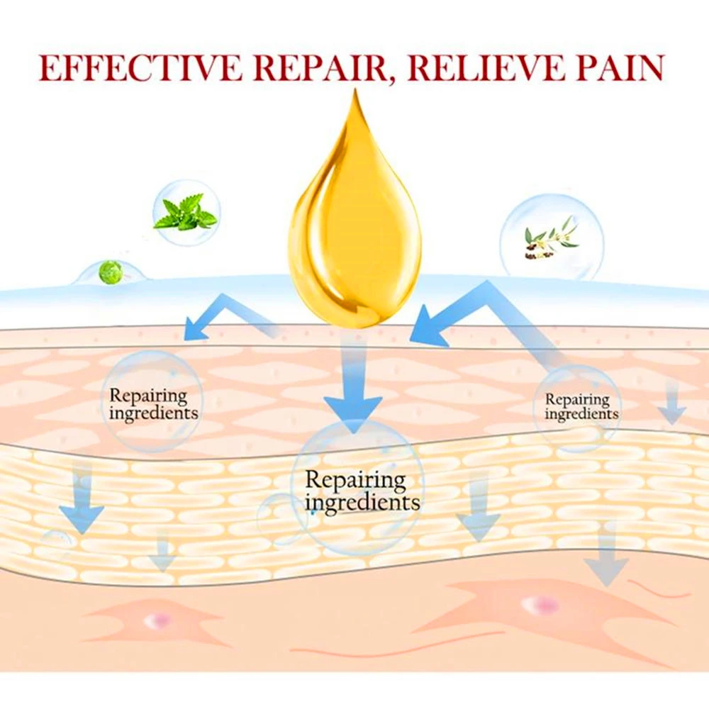 100% эфирные масла для дикого ревеня снятие боли в мышцах и спазме обезболивающий