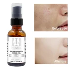 Гликолевая кислота 30% уменьшает поры, сыворотка для лица, очищает, отшелушивает кожу, контроль жирности, осветляет, выцветает, темные пятна, уход за кожей