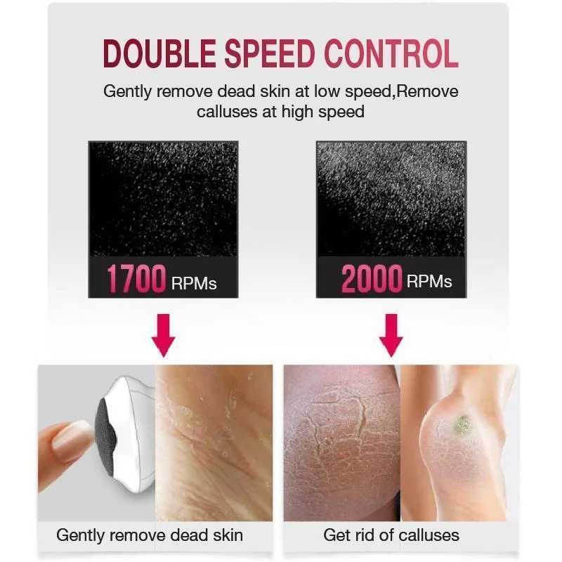 Электрическая шлифовальная машинка для ног перезаряжаемый аппарат удаления