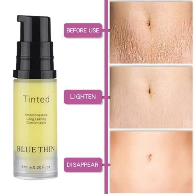 

Крем для гладкой кожи с растяжкой и эффектом устранения рубцов после родов