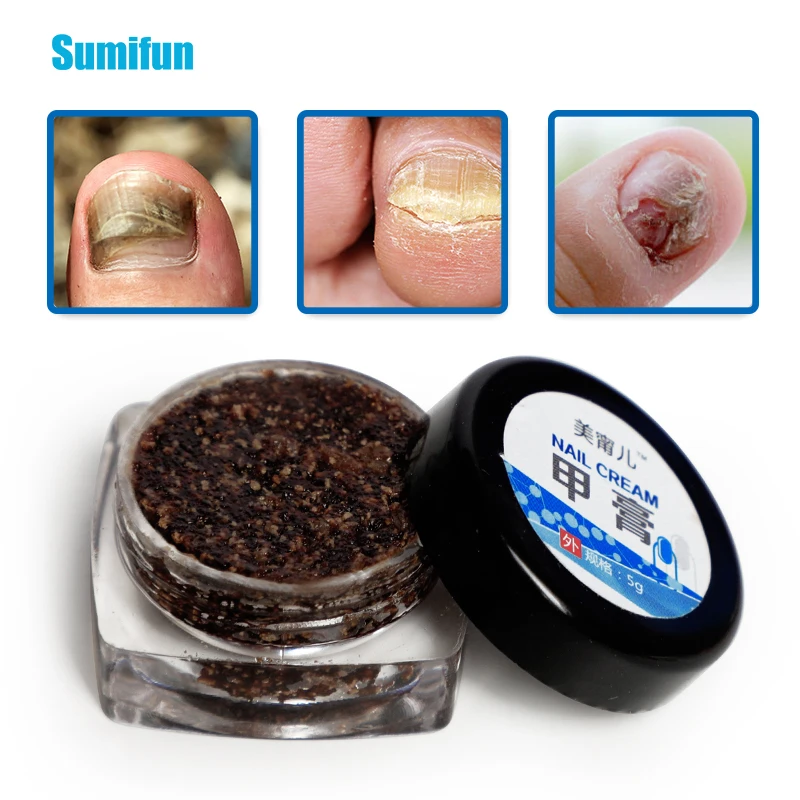 Крем от грибков 1 шт. ручка для лечения Ногтей онихомикоз против инфекции