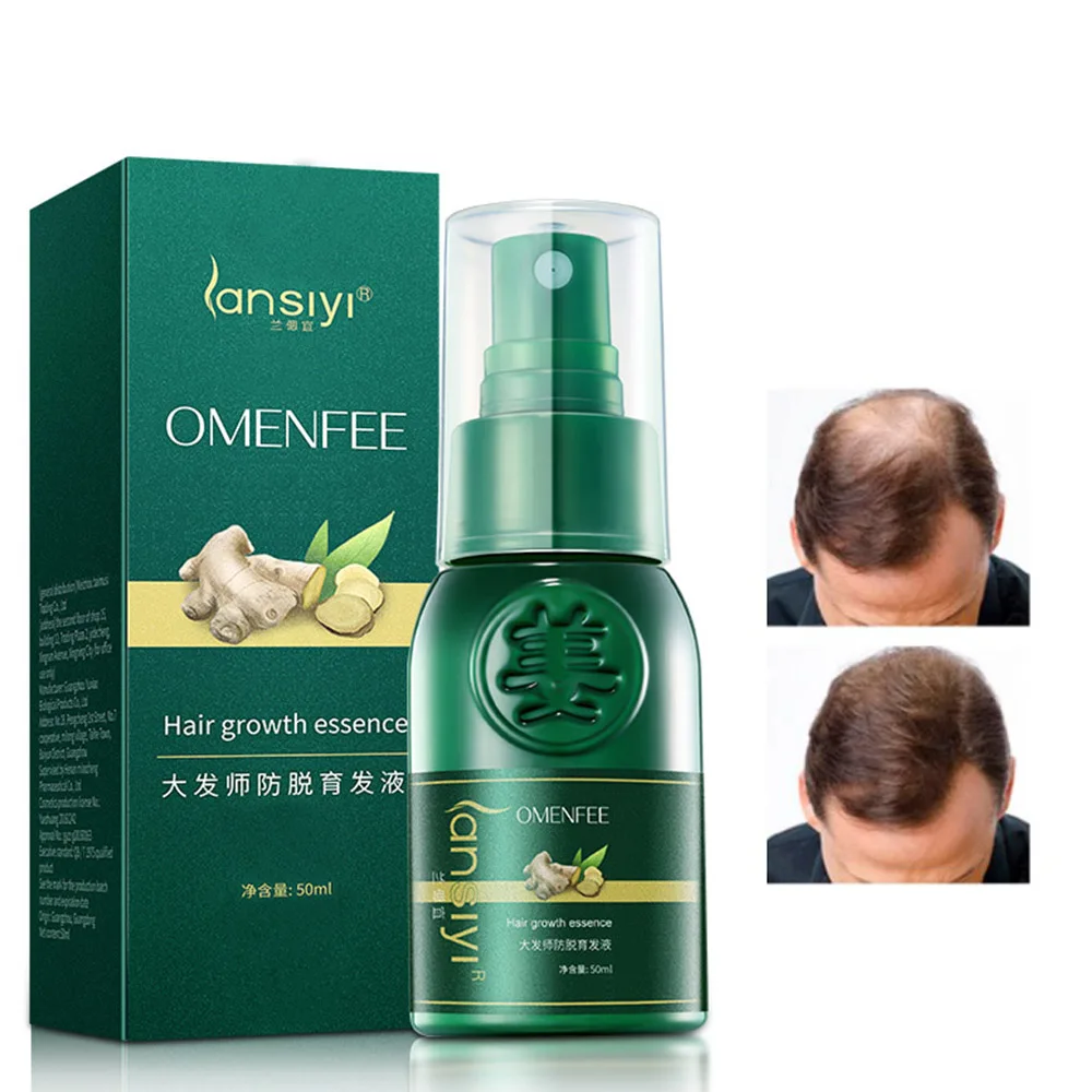 

30/50ML Ginger Hair Growth Spray Fast Hair Growth Serum Anti Hair Loss Hair Growth Spray Hair Growing Treatment Product