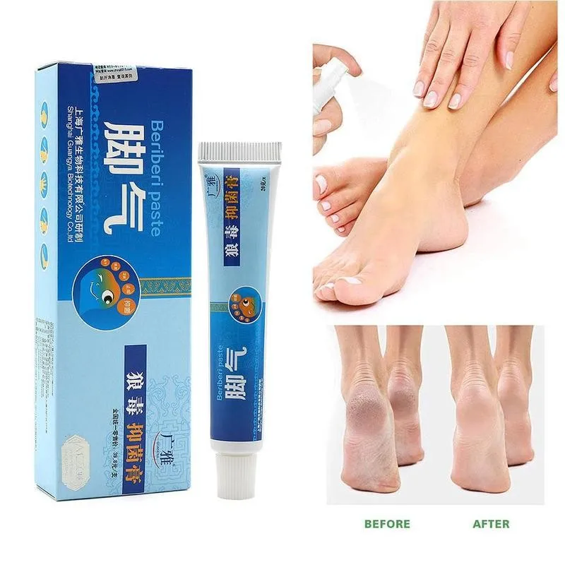 

20g Fungal Infection Foot Cream Feet Care For Athlete's Ointment Care Foot Erosive Peeling Bad Feet Feet Itchy Beriberi Bli K3B2