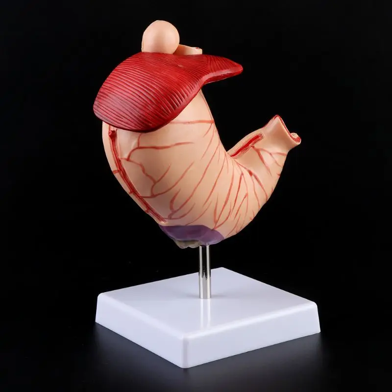 

Human Anatomical Anatomy Stomach Medical Model Gastric Pathology Gastritis Ulcer Medical Teaching Learning Tool Dropshipping