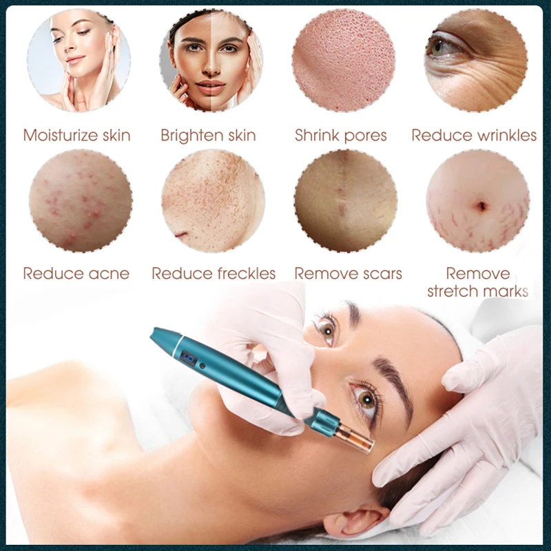 Рисунок 3 - F6S электрическая Дерма Ручка иглы