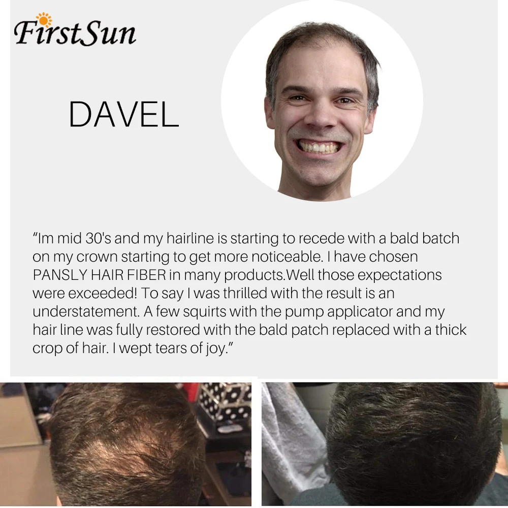 Новый аутентичный кератин 27 5 г спрей для наращивания черных волос порошок