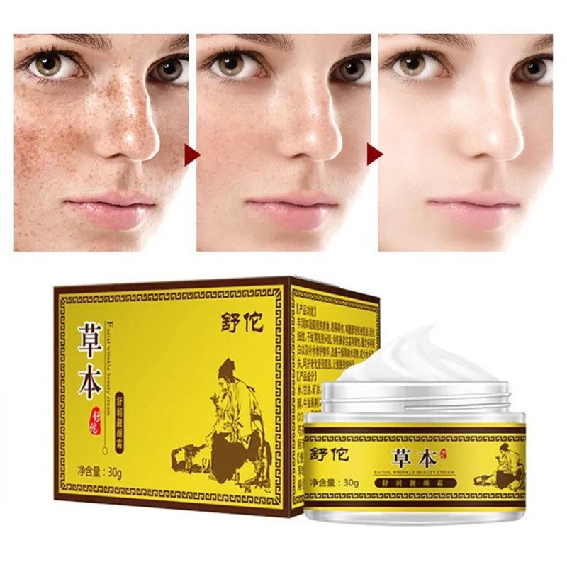 Крем для отбеливания веснушек удаление с лица Уход за лицом ремонта удаления