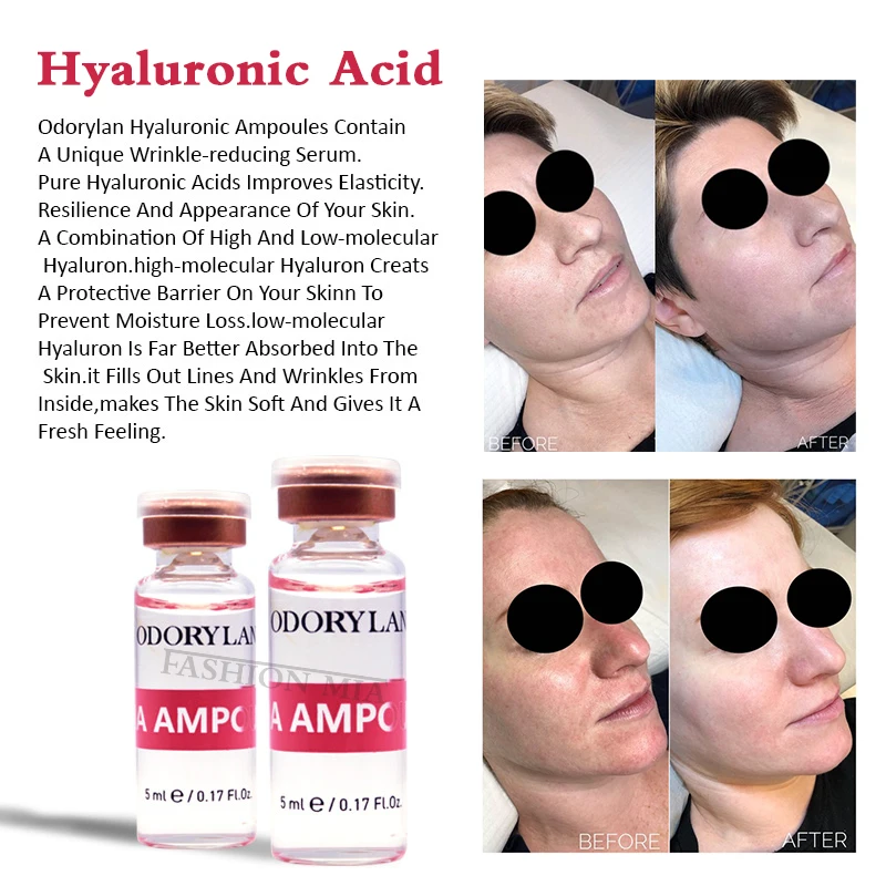 5ml Hyaluronic Acid for Microneedle Face Serum Essence Microneedling Filler Injection Dermapen Mesotherapy Collagen - купить по
