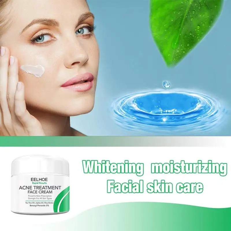 Botanical Anti-Acne Face Cream, Oil Control, Pore Shrinking Acne Scar Skin Anti-Acne Acne Whitening, Removal, Cream, and Cr O2O8