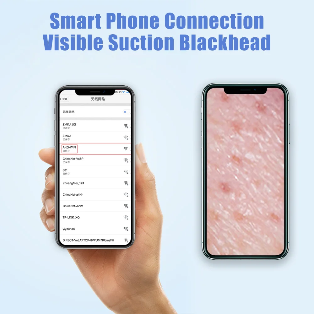 

Visual Blackhead Remover Vacuum Camera Face Pore Cleaner Acne Comedones Removal Facial Care Pimple Remover Tools Face Care