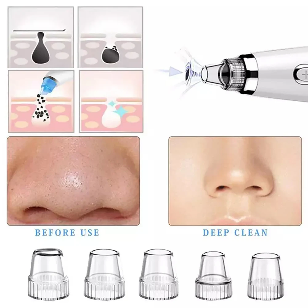 

Vacuum Pore Cleaner Face Nose Acne Black Dot Remover Replaceable Tip Blackhead Remover Vacuum Cleaner Skin Care Tools Machine