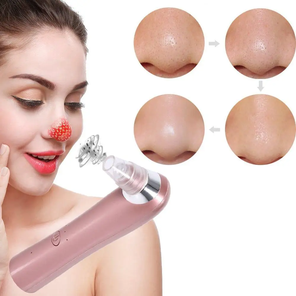 

Skin Care Facial Pore Blackhead Vacuum Suction Acne Black Dot Pimple Blackhead Remover Cleaner Professional Facial Care Tools