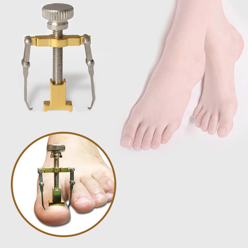 1 шт. вросший носок для коррекции ногтей Педикюр фиксатор выпрямитель клипперы