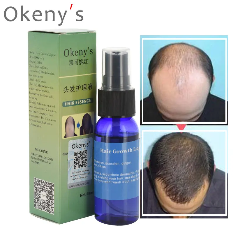 

Okeny's Ginger Andrea Hair Growth Essence Oil Fast Grow Dense Restoration Anti Hair Loss Product Sunburst Alopecia for Woman Man