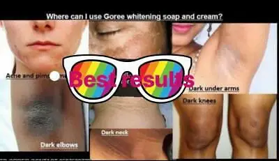 Оригинальный отбеливающий крем для кожи с витамином B3 авокадо и ALOEVERA бесплатная