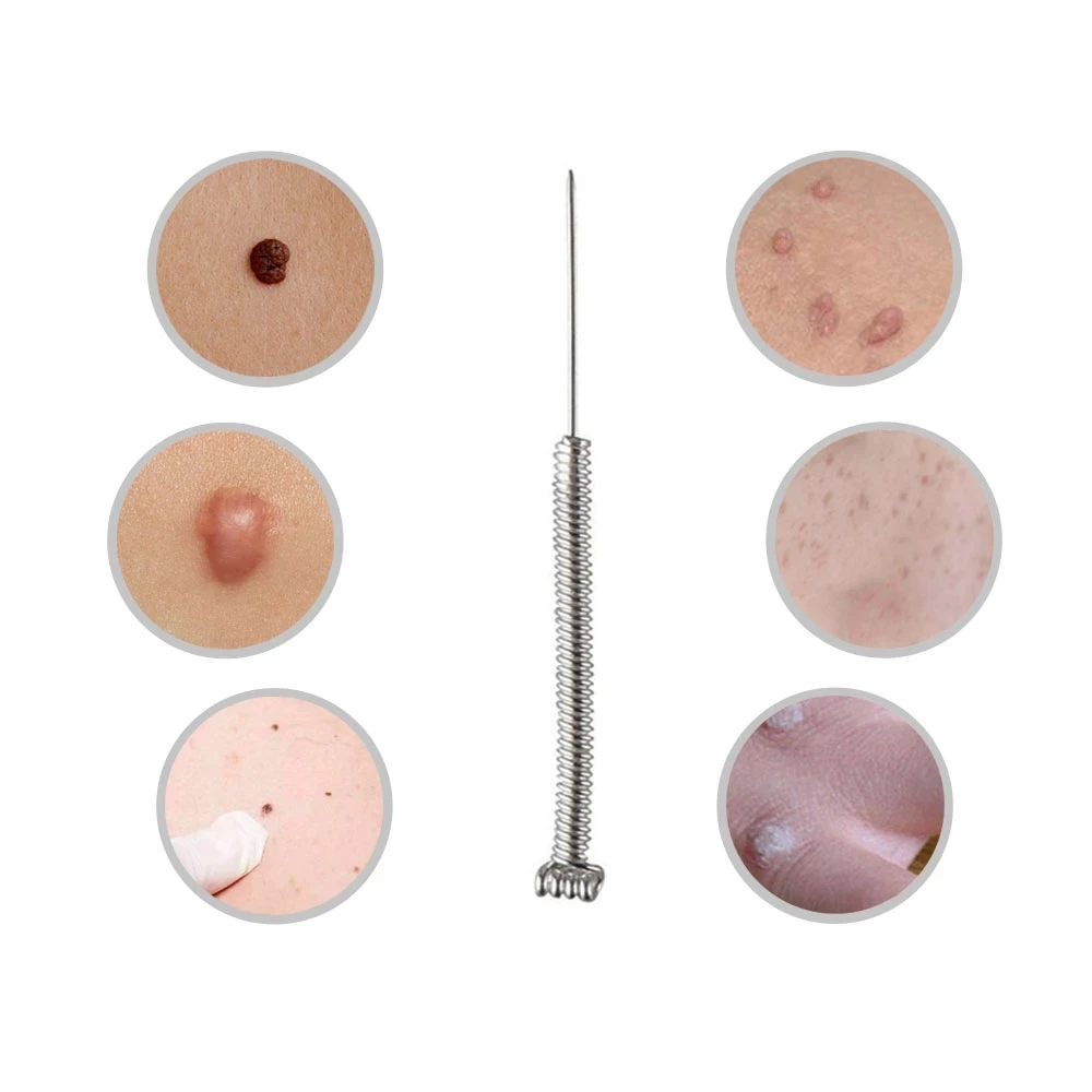 Иглы плазменные для машинки удаления черных точек и татуировок на лице 100 шт.