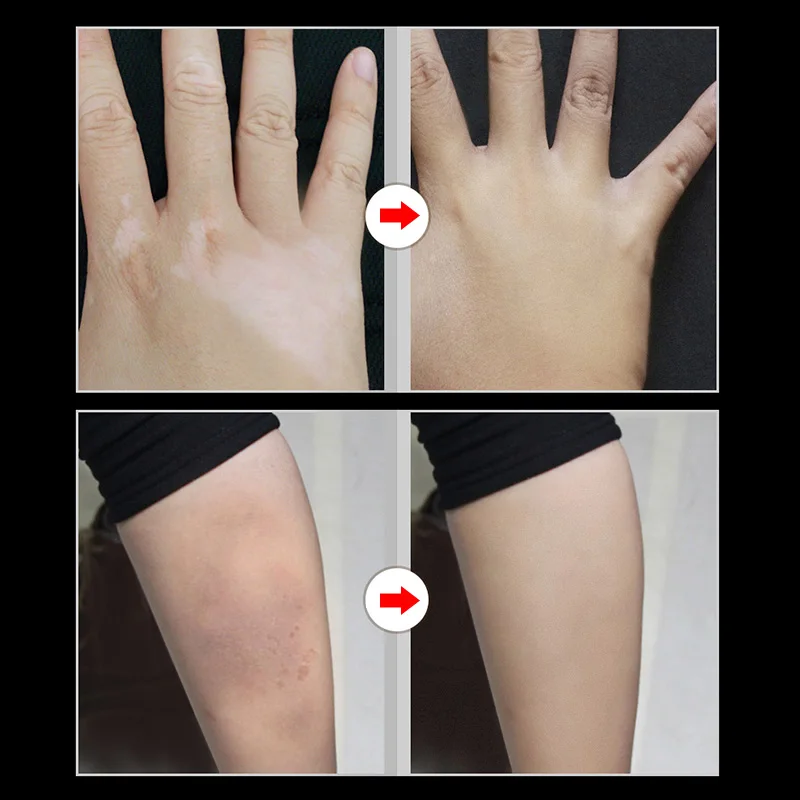 2 шт. крем консилер для макияжа| |