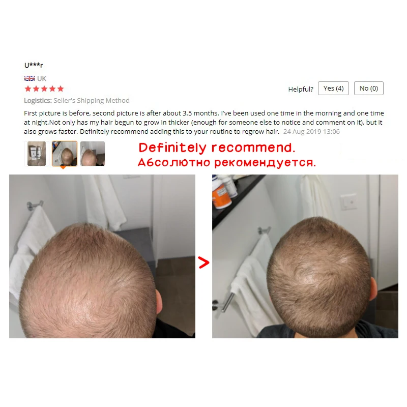 Спрей для роста волос OMY LADY эссенция против выпадения жидкая плотная