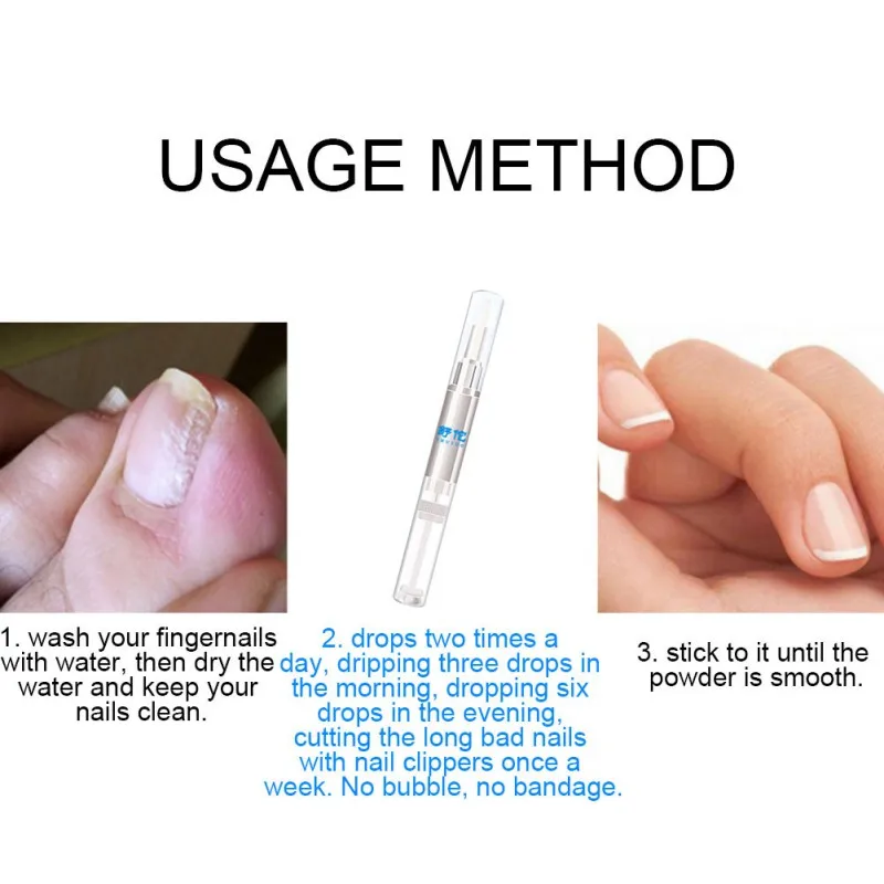 3ml Natural Herbal Toenail Fungus Nail Fungal Treatment Pen Nutrient Solution Feet Care Manicure Repair Gel Essence Tool | Красота и