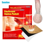 Пластырь для лечения варикозного расширения вен, васкулита, флебита, ног паука, китайского медицинский пластырь, 6 шт.