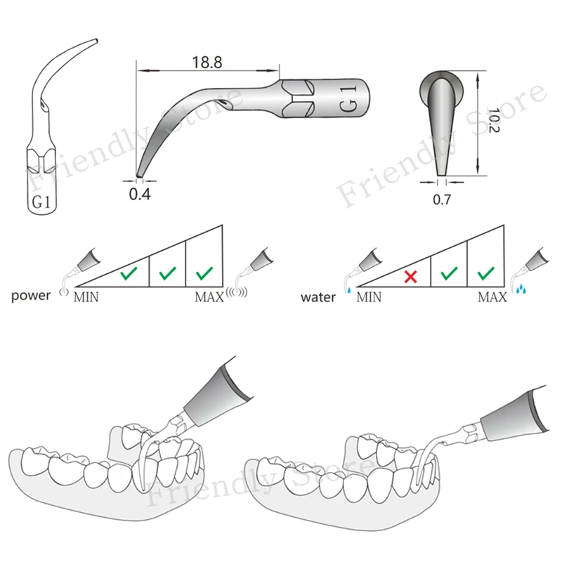 Уход за зубами 1 шт. G1 наконечники для стоматологического инструмента удаления