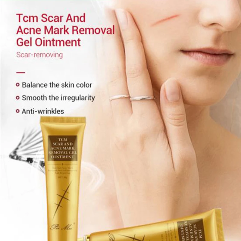 

30g Acne Scar Removal Cream Gel Face Pimples Stretch Marks Cream Repairing Smoothing Whitening Moisturizing Body Cream Skin Care