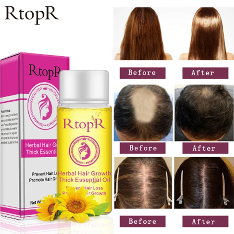 Травяное средство для роста волос жидкость против выпадения быстрого густых