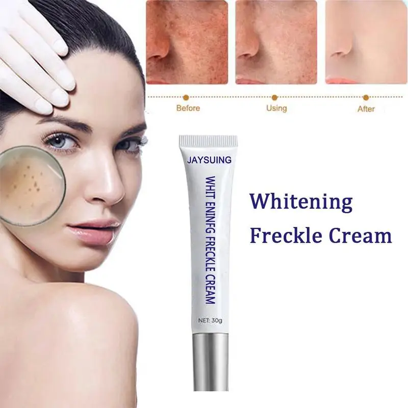 Blemish Cream Freckles Acne Pimple Scar Dark Spots Remove Skin Whitening Brightening