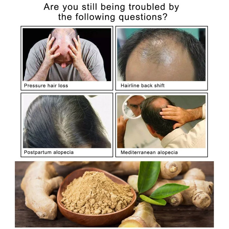 

30ml Hair Growth Essence Spray Anti Hair Loss Treatment Essential Oil Preventing Baldness Consolidating Nourish Roots Hair