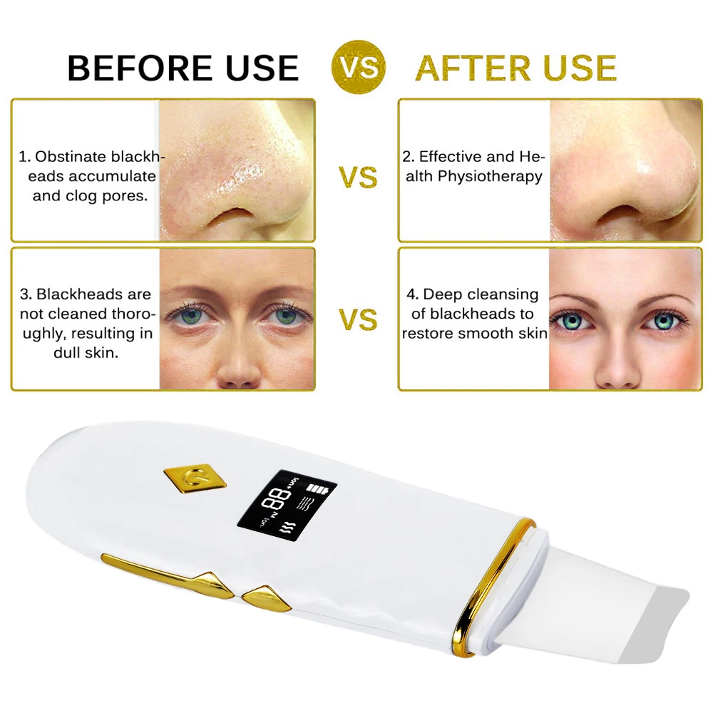 Ультразвуковой аппарат для удаления черных точек морщин пятен лица|Устройства