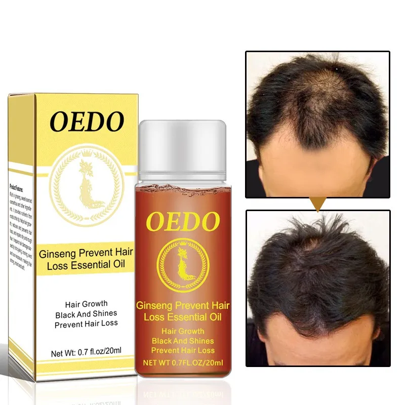 

OEDO Ginseng Hair Growth Essential Oil Prevents Hair Loss Repair Damage Hair Promove Fast-growing Hair Nourishes Root Hair Care