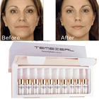 10 шт. гиалуроновая отбеливающая бесточечная сыворотка ампулы с нулевым пигментом экстракт анацинамида жидкое увлажнение