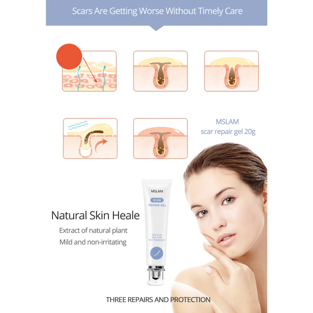 20g Body Scrubs Scar Removal Cream Skin Trauma Surgery Repair Acne Essence Gel Care Products |