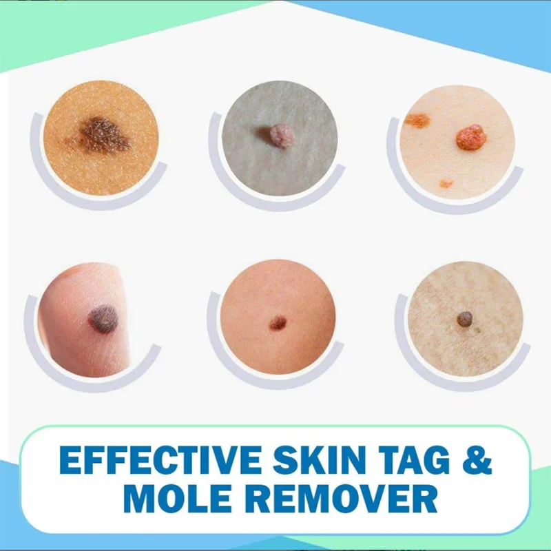 Средство для восстановления костей носа крем подтяжки тонкого сужение эфирное