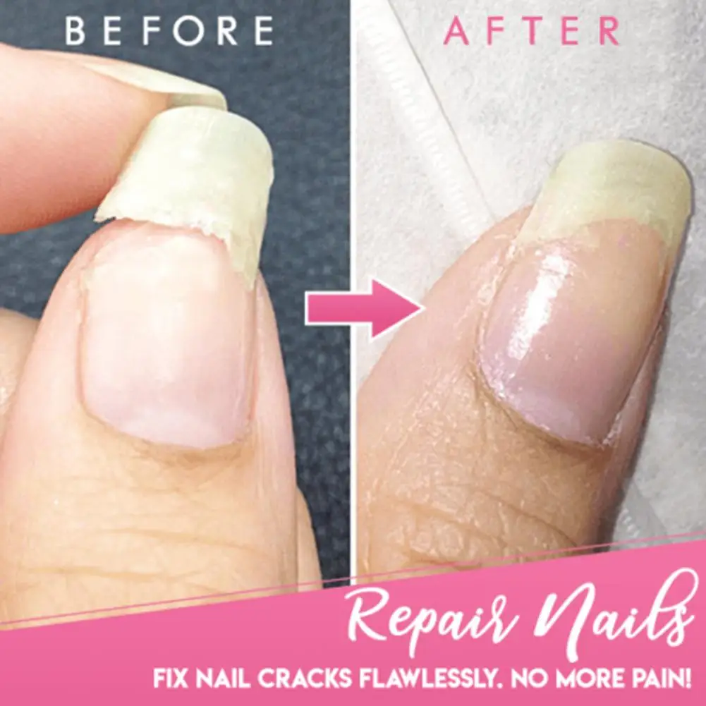 

Cracked Nail Repair Gel Fiberglass Extension Building Broken Nails Restore Soak Off Glue Gel