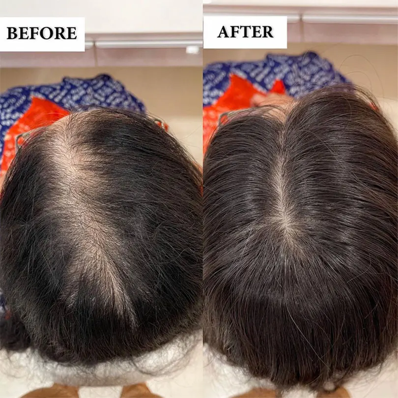 Cobertura de Seda do Cabelo Reta de Seda do Topper Natural da Cor Humano do Virgin da Base com 4 Clipes em 13x12cm em Linha Feminino Densidade 130