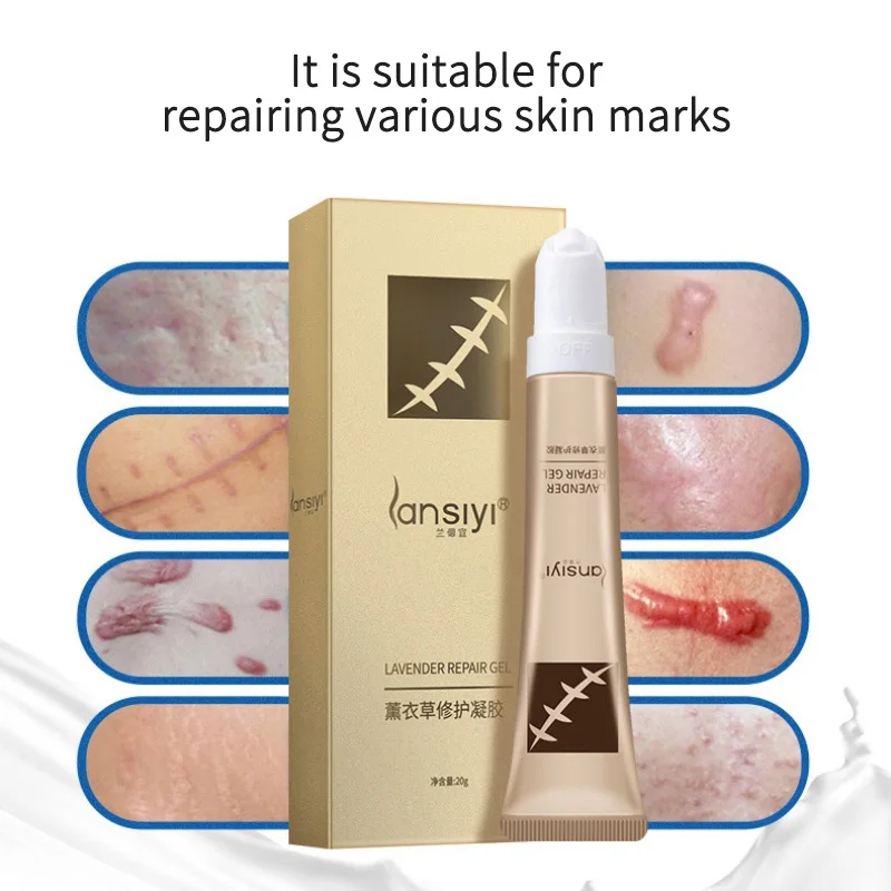 Lavender Scar Repair Cream Moisturizing Dilute Pigment Remove Scars Pimple Marks Acne Spots Whitening Cream Face Care TSLM2