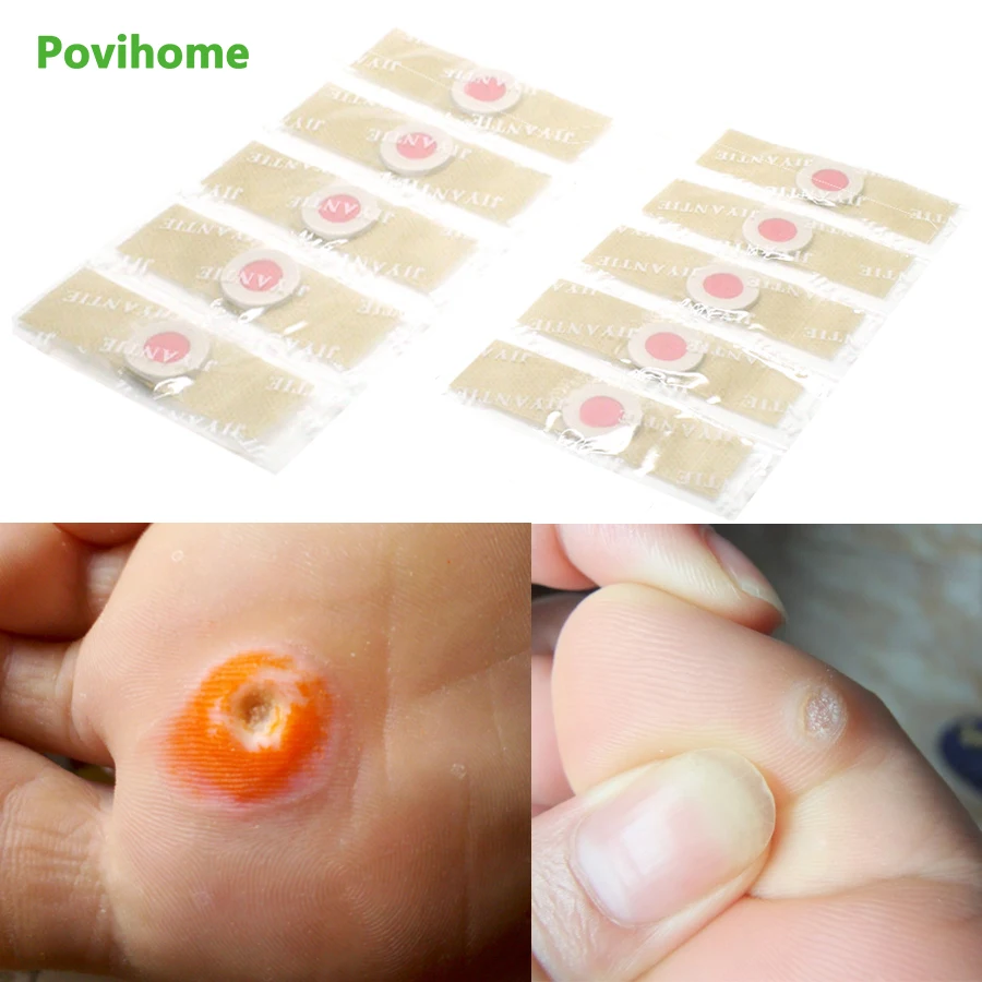 

24pcs Foot Corn Plaster Pads Patches Medical Plaster Foot Corn Removal Remover Warts Thorn Callus Corn Foot Care D1467