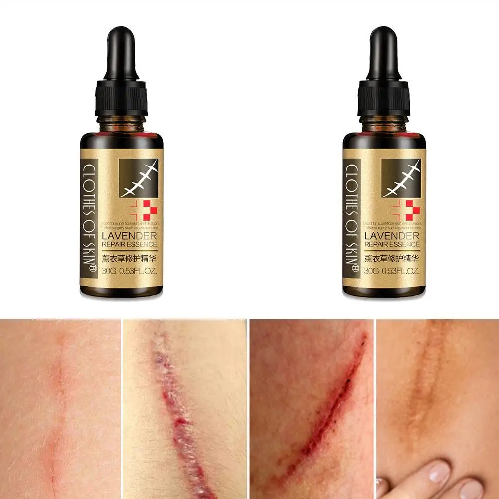

Lavender Repair Essence Dilutes Imprints Repairs Skin&Makes Essential Nourishes Firmer Skin Oil Smooth Massage C5H0