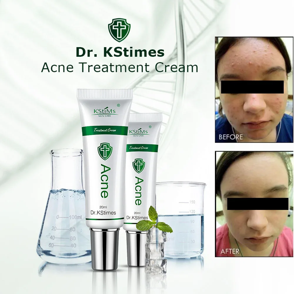 

KStims Acne Scar Removal Cream Skin Care Repair Face Day Night Cream