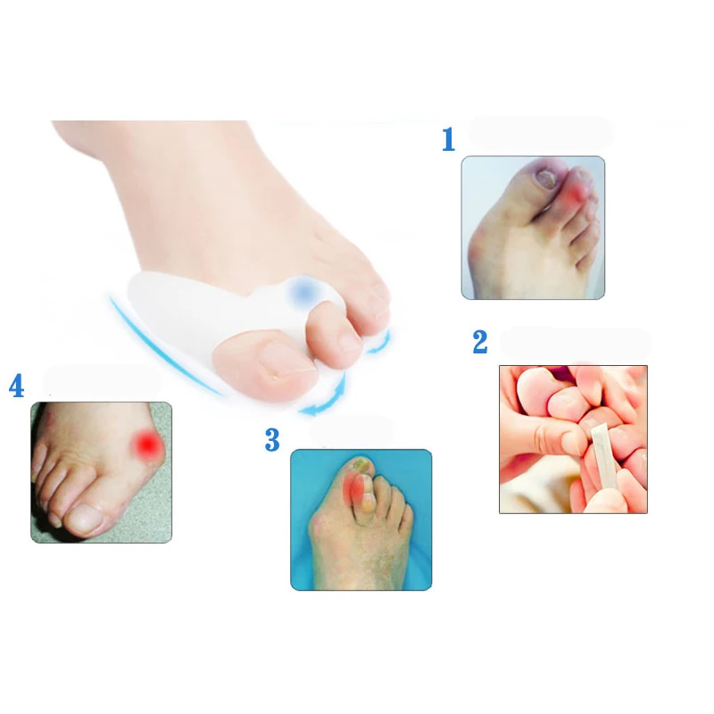

2pcs=1pair Bunion Adjuster Guard Foot Care Tool Silicone Thumb Hallux Valgus Correction Gel Toe Ring Toe Separator Protector