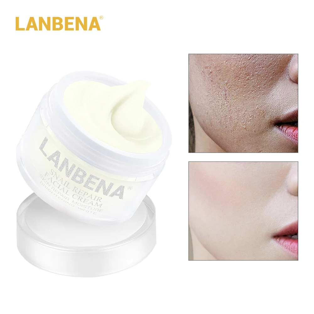 LANBENA с экстрактом улитки восстановление и отбеливание крем для лица покрытыем