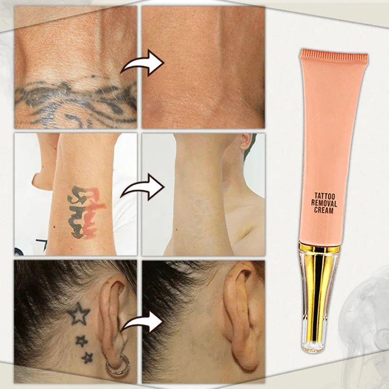 

Tattoo Removal Cream Painless Remove Tattoo Ink Remover Without Scarring No Hurt Safe Gentle MH88