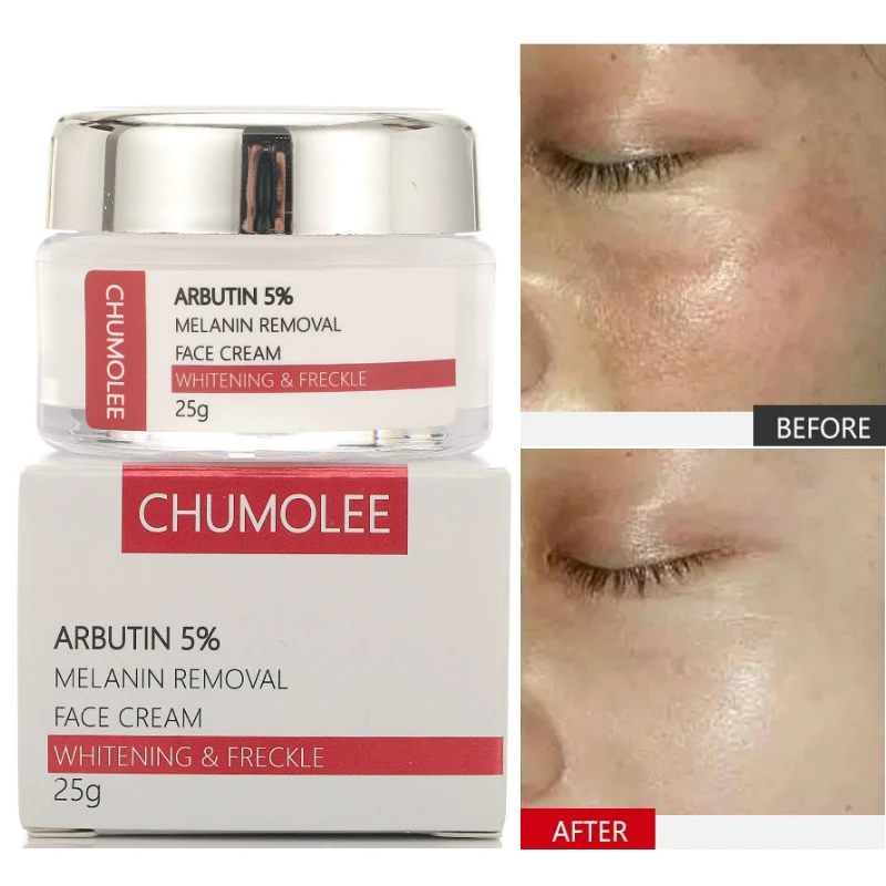 Альфа арбутин CHUMOLEE 5% отбеливающий крем для лица лечение веснушек мелазмы акне