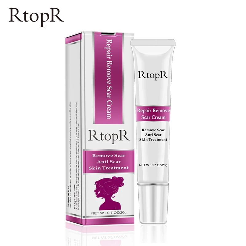 20G Remover Cream Acne Scar Stretch Marks Skin Repair Face Cream Acne Spots Acne Treatment Blackhead Whitening Cream Skin Care