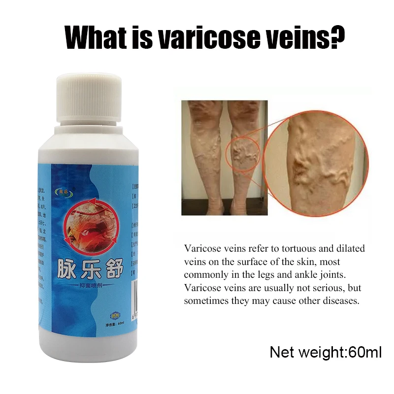 60 мл васкулит спрей для лечения варикозного расширения вен на ногах кислота