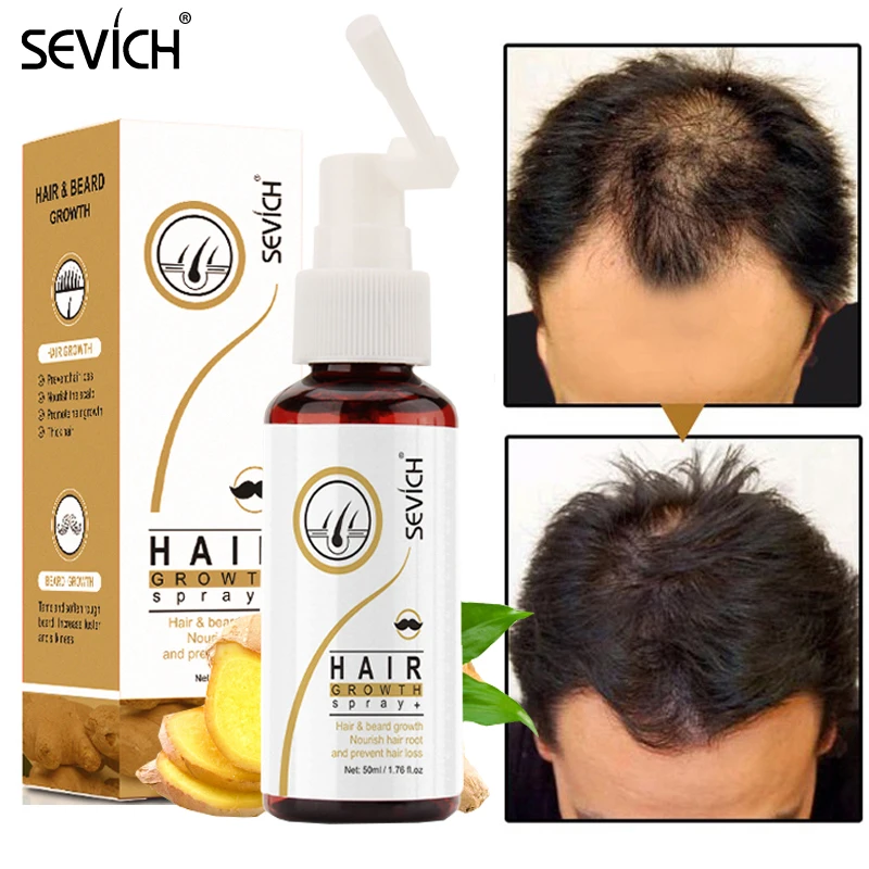 50ML Sevich Hair Growth Spray Ginger Fast Grow Hair Essence Oil Hair Loss Treatment Anti Hair Loss Repair Damaged Hair Care